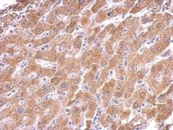 CS Citrate Synthase Antibody (2061), Novus Biologicals 0.1mL; Unlabeled:Antibodies,