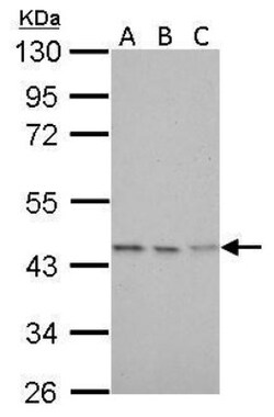 CS Citrate Synthase Antibody (2061), Novus Biologicals 0.1mL; Unlabeled:Antibodies,