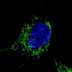 CS Citrate Synthase Antibody (CL2545), Novus Biologicals:Antibodies:Primary