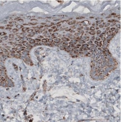 CS Citrate Synthase Antibody (CL2545), Novus Biologicals:Antibodies:Primary