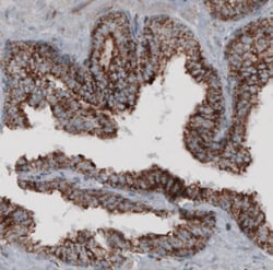 CS Citrate Synthase Antibody (CL2545), Novus Biologicals:Antibodies:Primary