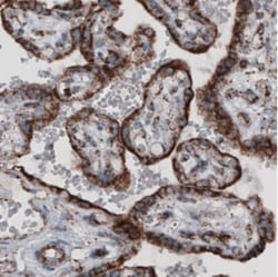 CS Citrate Synthase Antibody (CL2545), Novus Biologicals:Antibodies:Primary