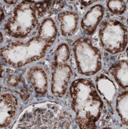 CS Citrate Synthase Antibody (CL2545), Novus Biologicals:Antibodies:Primary