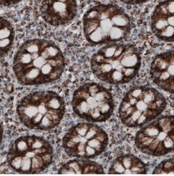 CS Citrate Synthase Antibody (CL2545), Novus Biologicals:Antibodies:Primary