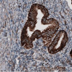 CS Citrate Synthase Antibody (CL2545), Novus Biologicals:Antibodies:Primary