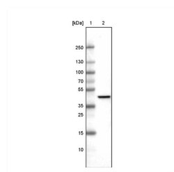 CS Citrate Synthase Antibody (CL2545), Novus Biologicals:Antibodies:Primary