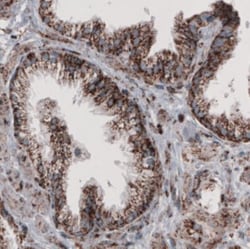 CS Citrate Synthase Antibody (CL2561), Novus Biologicals:Antibodies:Primary
