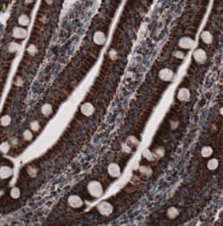 CS Citrate Synthase Antibody (CL2561), Novus Biologicals:Antibodies:Primary