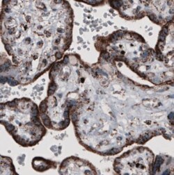 CS Citrate Synthase Antibody (CL2561), Novus Biologicals:Antibodies:Primary