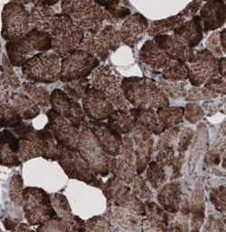 CS Citrate Synthase Antibody (CL2561), Novus Biologicals:Antibodies:Primary