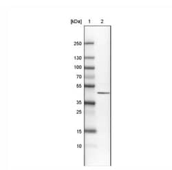 CS Citrate Synthase Antibody (CL2561), Novus Biologicals:Antibodies:Primary