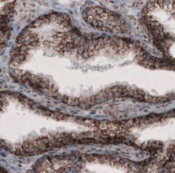 CS Citrate Synthase Antibody (CL2579), Novus Biologicals 0.1mL; Unlabeled:Antibodies,