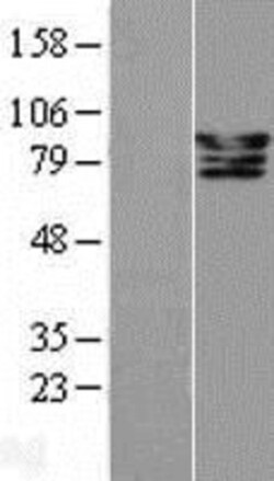 Novus Biologicals&trade;&nbsp;CSDE1 Overexpression Lysate