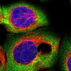 CSDE1 Antibody, Novus Biologicals 0.1mL; Unlabeled:Antibodies, Polyclonal