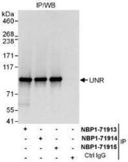 CSDE1 Antibody, Novus Biologicals 0.1mg; Unlabeled:Antibodies, Polyclonal