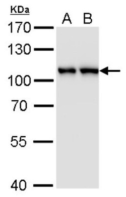 CSE1L/CAS/Exportin-2 Antibody (5111), Novus Biologicals 0.1mL; Unlabeled:Antibodies,