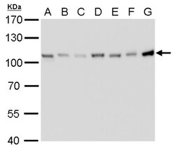 CSE1L/CAS/Exportin-2 Antibody (729), Novus Biologicals 0.1 mL | Buy Online | Novus Biologicals | Fisher Scientific