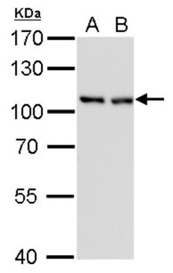 CSE1L/CAS/Exportin-2 Antibody (729), Novus Biologicals 0.1 mL | Buy Online | Novus Biologicals | Fisher Scientific