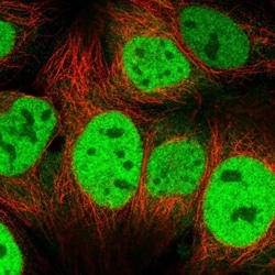 CSE1L/CAS/Exportin-2 Antibody, Novus Biologicals 0.1mL; Unlabeled:Antibodies,
