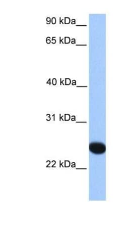 CSGLCAT Antibody, Novus Biologicals 100&mu;L; Unlabeled:Antibodies, Polyclonal