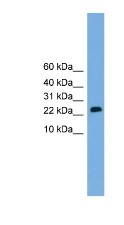 CSH2 Antibody, Novus Biologicals 100&mu;L; Unlabeled:Antibodies, Polyclonal