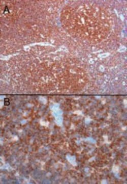 CSK Antibody, Novus Biologicals 0.1mg; Unlabeled:Antibodies, Polyclonal