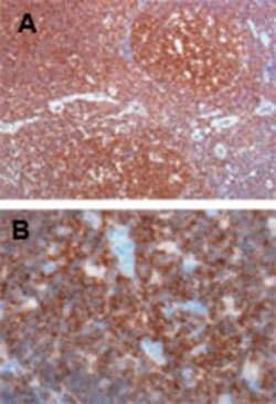 CSK Antibody, Novus Biologicals 0.1mg; Unlabeled:Antibodies, Polyclonal