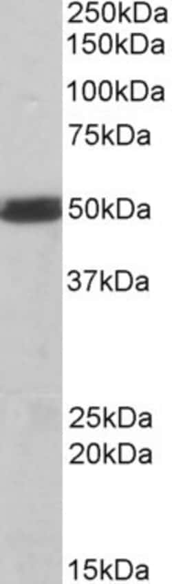 CSK Antibody, Novus Biologicals 0.1mg; Unlabeled:Antibodies, Polyclonal