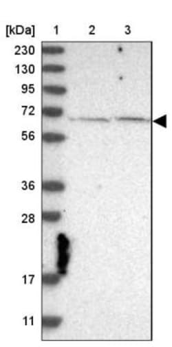 CSK Antibody, Novus Biologicals 0.1mL; Unlabeled:Antibodies, Polyclonal