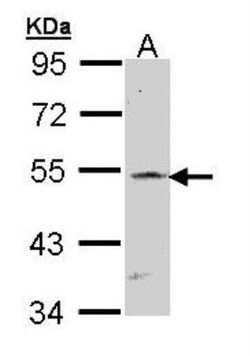 csl/RBPJK Antibody, Novus Biologicals 0.1mL; Unlabeled:Antibodies, Polyclonal