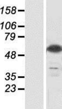 Novus Biologicals™ CSN1 Overexpression Lysate