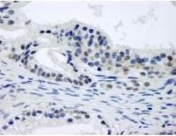 CSN1 Antibody, Novus Biologicals 0.1mg; Unlabeled:Antibodies, Polyclonal