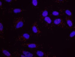 CSN1 Antibody, Novus Biologicals 0.1mg; Unlabeled:Antibodies, Polyclonal