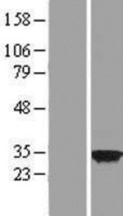 Novus Biologicals&trade;&nbsp;CSN7b Overexpression Lysate