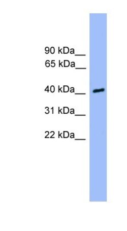 CSNK1A1L Antibody, Novus Biologicals 100μL; Unlabeled:Antibodies, Polyclonal