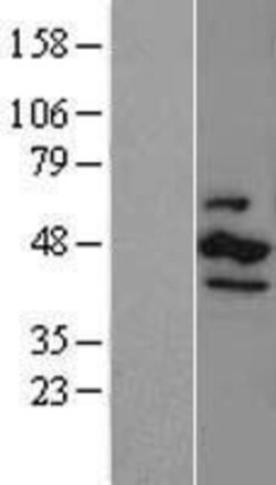 Novus Biologicals&trade;&nbsp;Casein Kinase 1 epsilon Overexpression Lysate