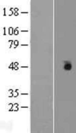 Novus Biologicals Casein Kinase 1 gamma Overexpression Lysate 0,1 mg | Buy Online | Novus Biologicals&trade; | Fisher Scientific