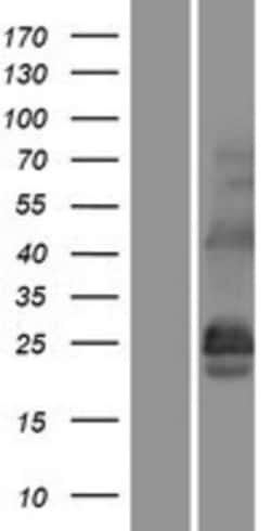 Novus Biologicals™ CSP Overexpression Lysate
