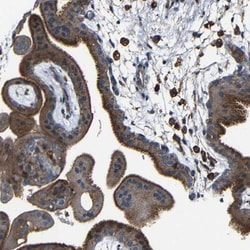 CSP Antibody, Novus Biologicals:Antibodies:Primary Antibodies