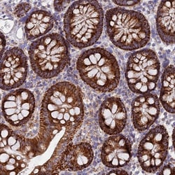 NG2/MCSP Antibody, Novus Biologicals:Antibodies:Primary Antibodies