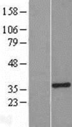 Novus Biologicals&trade;&nbsp;SULT1A3 Overexpression Lysate