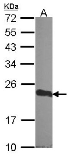CSRP1 Antibody, Novus Biologicals 0.1mL; Unlabeled:Antibodies, Polyclonal