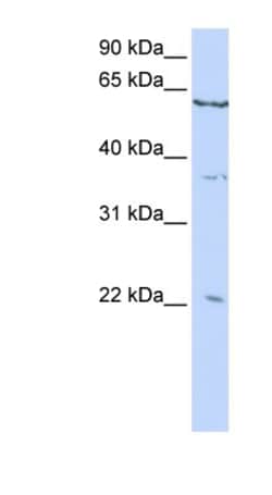 CSRP2 Antibody, Novus Biologicals 100&mu;L; Unlabeled:Antibodies, Polyclonal