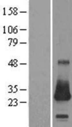 Novus Biologicals&trade;&nbsp;CSRP2 Overexpression Lysate