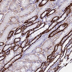 CSRP2 Antibody, Novus Biologicals:Antibodies:Primary Antibodies