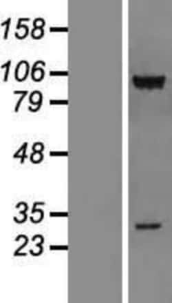Novus Biologicals&trade;&nbsp;CSRP2BP Overexpression Lysate