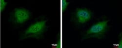 CSRP2BP Antibody, Novus Biologicals 0.1mL; Unlabeled:Antibodies, Polyclonal