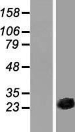 Novus Biologicals&trade;&nbsp;CSRP3 Overexpression Lysate
