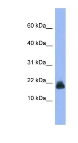Cystatin E/M/CST6 Antibody, Novus Biologicals 100&mu;L; Unlabeled:Antibodies,
