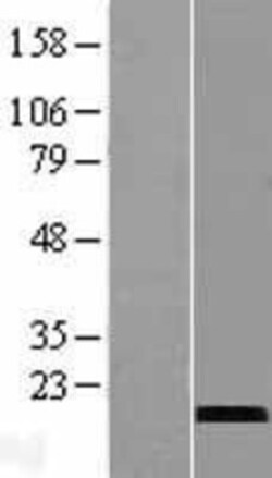 Novus Biologicals&trade;&nbsp;CST9L Overexpression Lysate